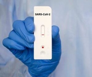 Počet pozitivních záchytů klesá, firmy volají po posílení systému konfirmačních PCR testů